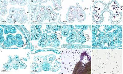 Identification of male-fertility gene AsaNRF1 and molecular marker development in cultivated garlic (Allium sativum L.)